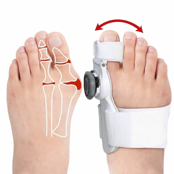 Verstelbare hallux valguscorrector