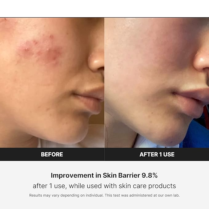 EMS Gezicht & Nek Massager - Therapie voor een liftende en stevige huid