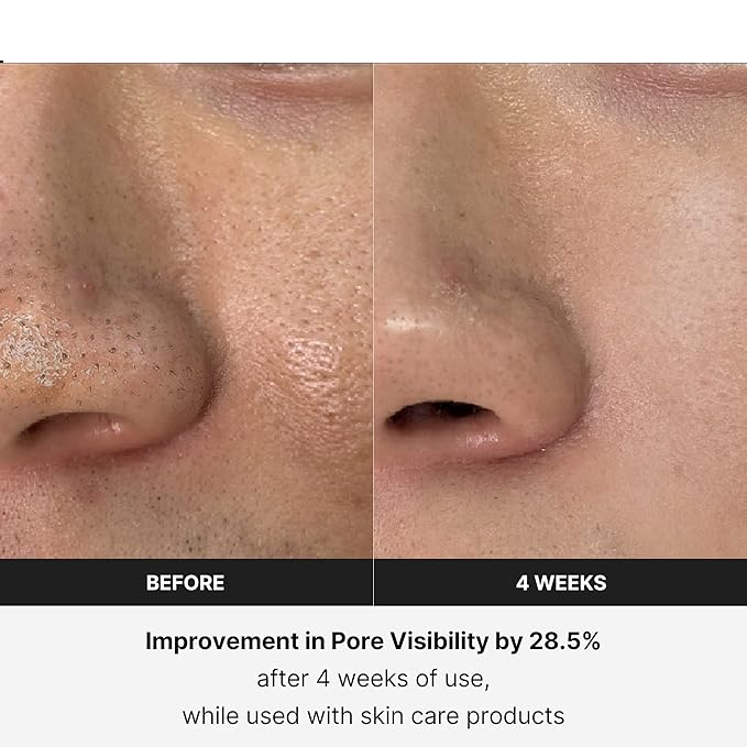 EMS Gezicht & Nek Massager - Therapie voor een liftende en stevige huid