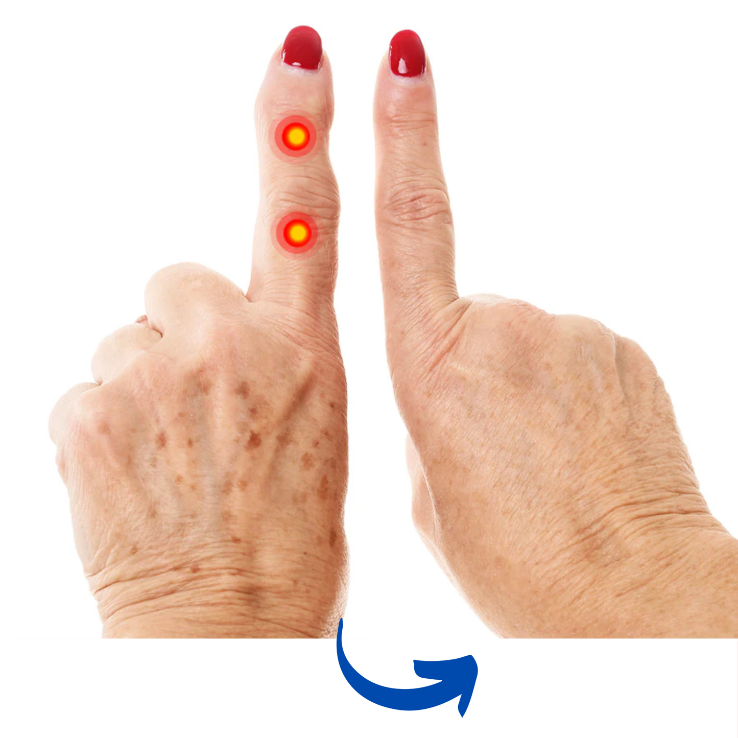 Infrarood handtherapiehandschoen – pijnverlichting en ondersteuning van gewrichten
