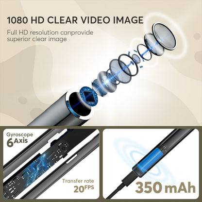 Slimme oorsmeer verwijderingsset – Oorreiniger met camera